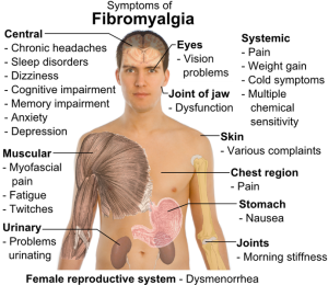 sintomi-fibromialgia